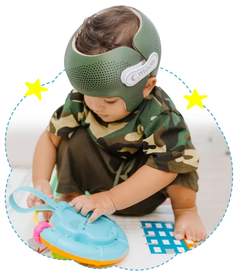 Fisioterapia Bebê | Capacetes 3D | Capacete CMoon