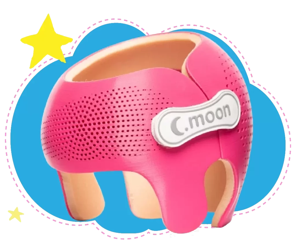 Fisioterapia Bebê | Capacetes 3D | Capacete CMoon Adaptado