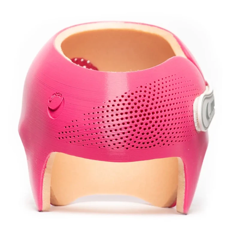 fisioterapiabebe_cmoon_capacete_rosa1