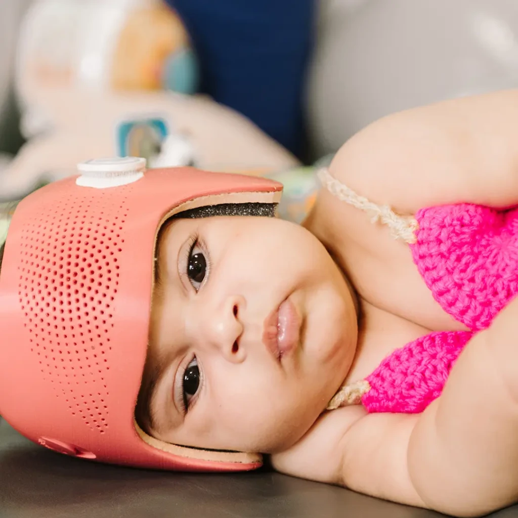 fisioterapiabebe_assimetria craniana_bebe cabecinha torta_02