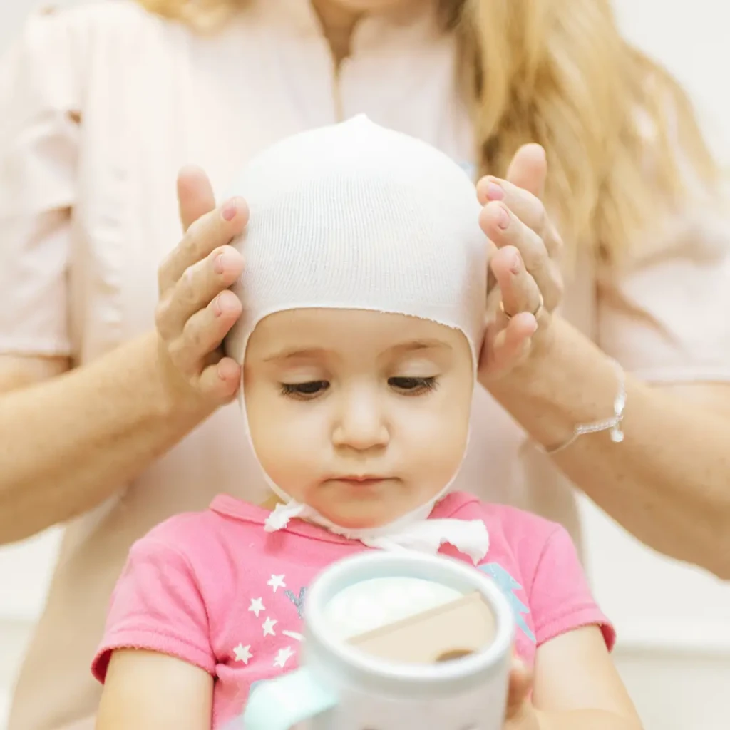 fisioterapiabebe_craniossinostose